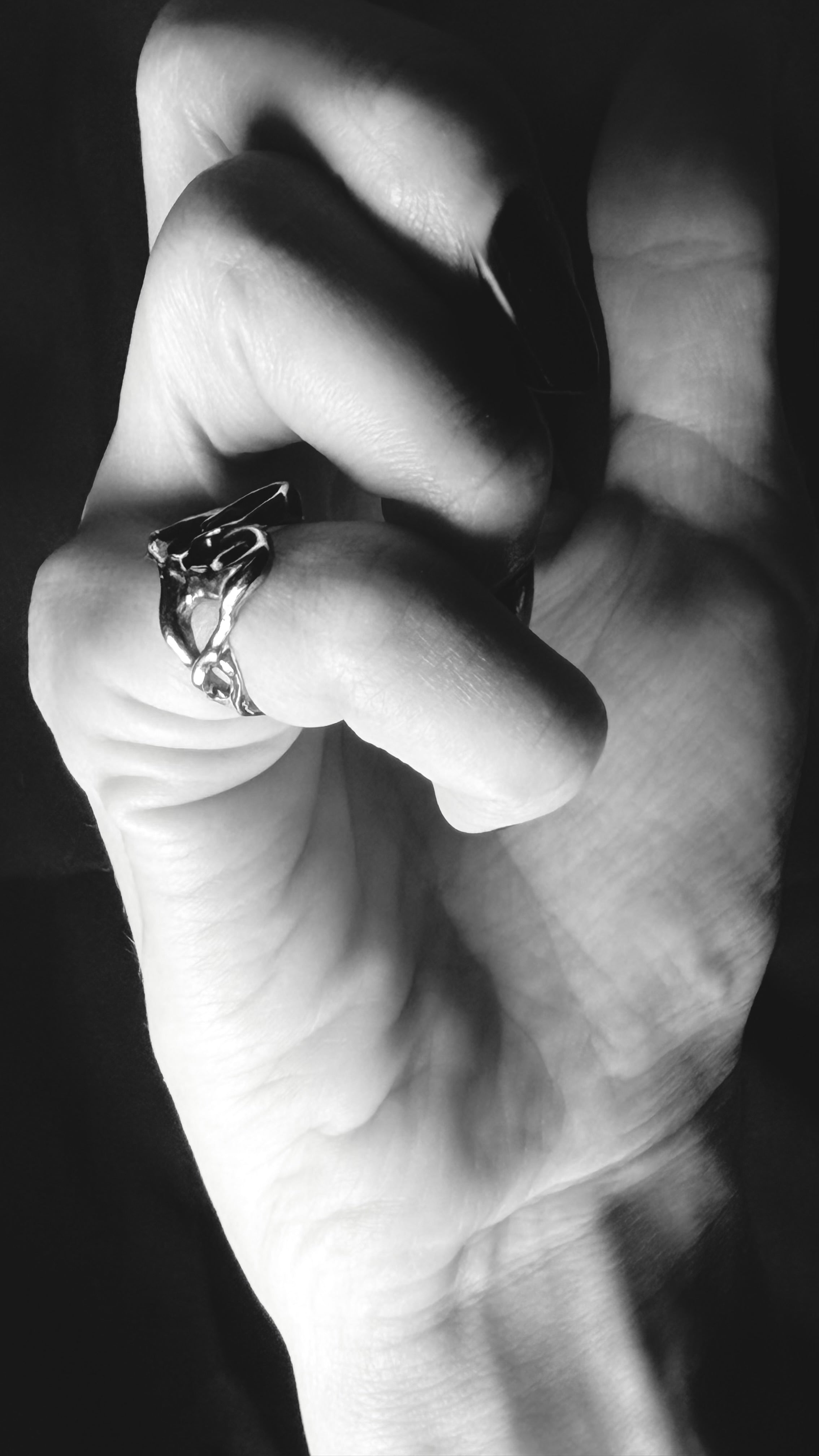 It Hurts ring